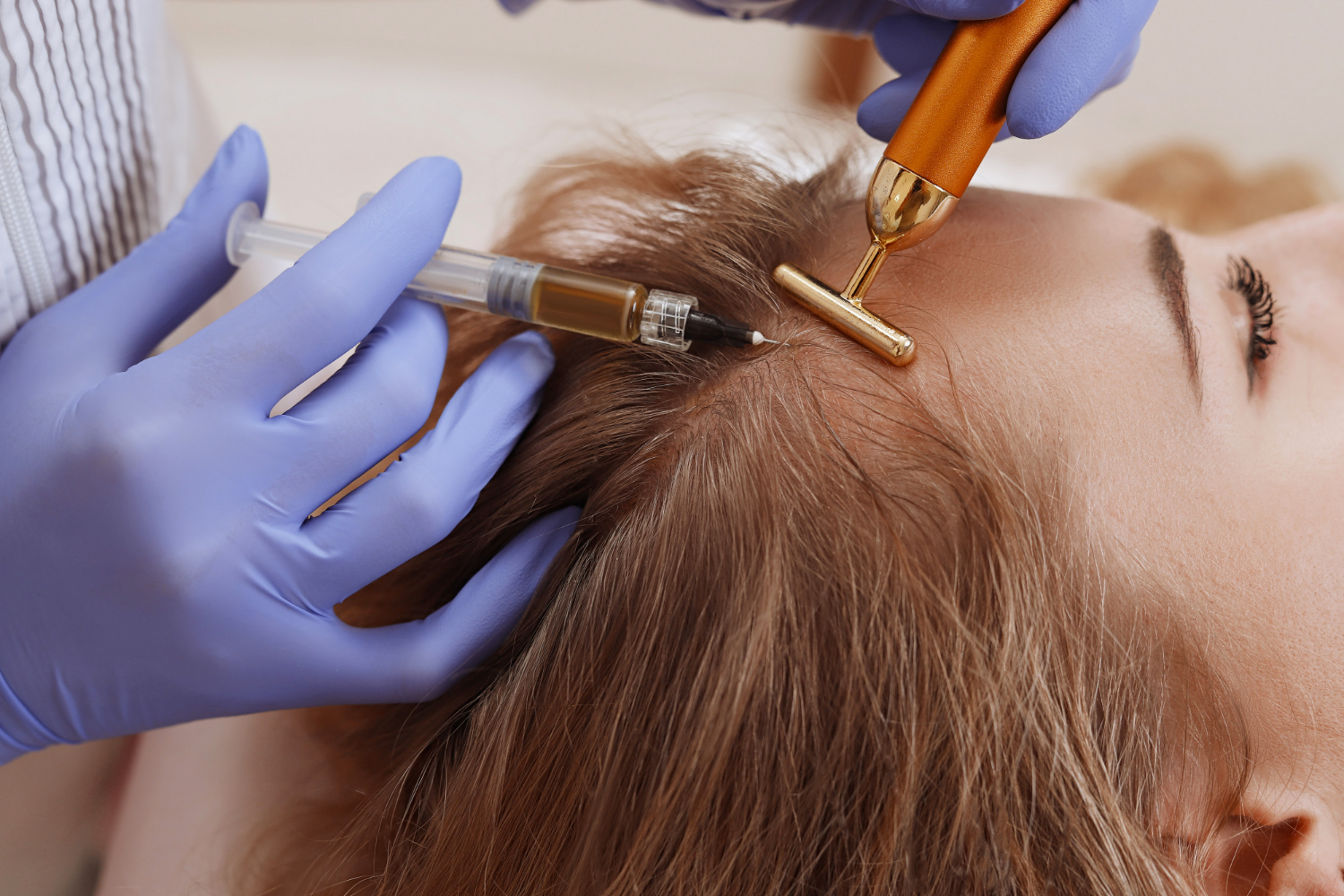 Tratamientos Capilares - CLS Medicina Estética