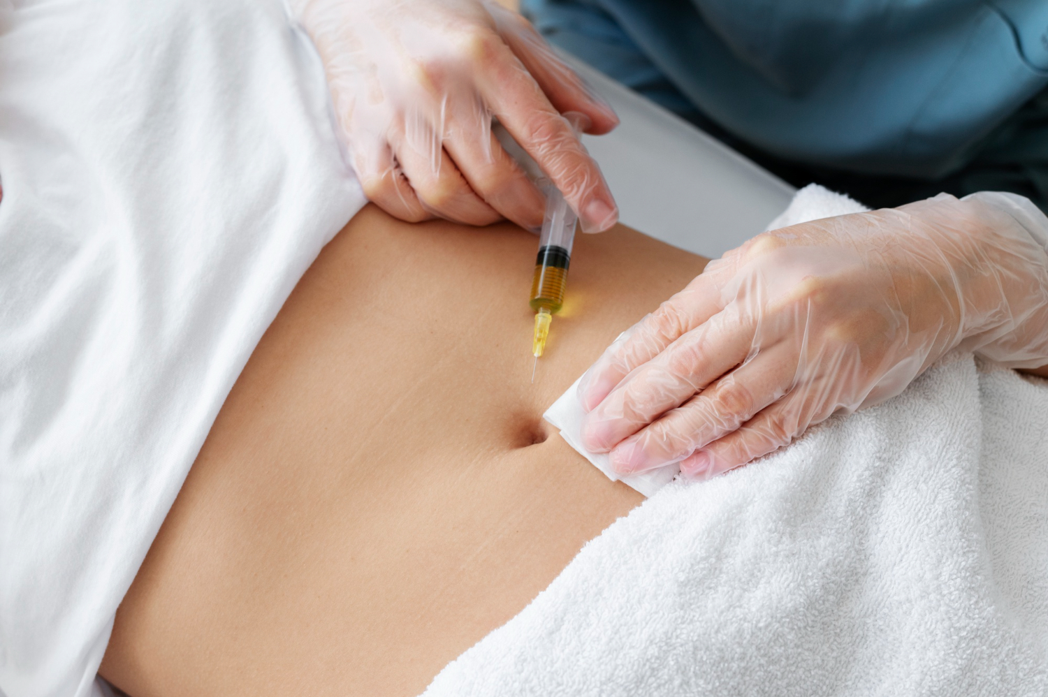 Mesoterapia con Alidya - CLS Medicina Estética
